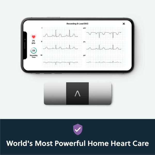 Kardia Mobile EKG