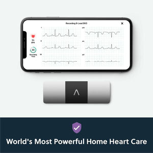 Kardia Mobile EKG